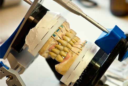 Articulator, ARCUSdigma II  - Kreativ Dental Clinic