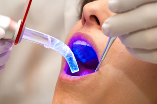 Cosmetic Dental treatment Dental center Dr. Batkoski in Ohrid