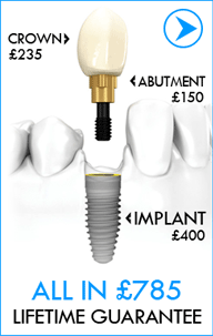 Dental Implant £785 LIFETIME GUARANTEE